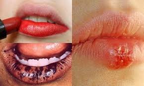 Tác hại của son môi gia công 