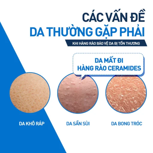 Kem dưỡng ẩm phục hồi chuyên sâu và giữ da ẩm mịn suốt 48H CERAVE MOISTURISING CREAM 340G - Hình ảnh 3