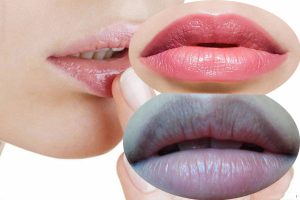 Nguyên nhân gây ra thâm môi và gợi ý màu son hợp với môi thâm